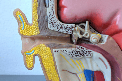 Hydrops endolymphatique : causes, symptômes et traitement